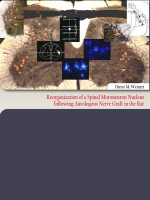 cover image of Reorganization of  a Spinal Motoneuron Nucleus following Autologous Nerve Graft in the Rat